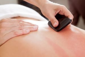 Gua sha being performed a back